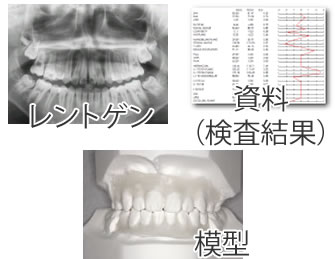 レントゲン　検査結果　模型